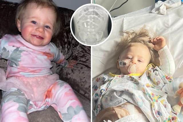 Hannah Whateley wants to raise awareness of the dangers of tiny magnetic balls to prevent other families from going through what her daughter Araya has experienced.