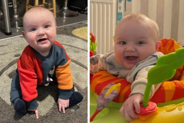 It was confirmed Beau had severe plagiocephaly just weeks ago, but his mother had her suspicions since he was eight weeks old.