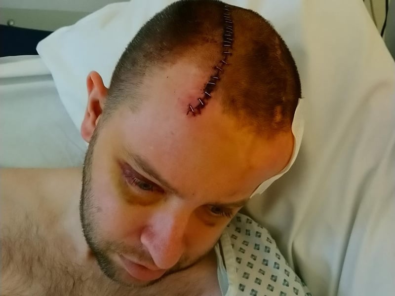 Simon pictured in February 2023 after surgery.