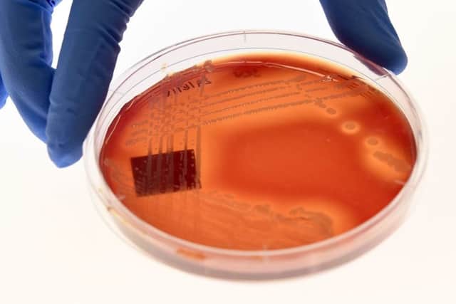 The bugs include strains of bacteria that can trigger life-threatening illnesses (Photo: Getty Images)