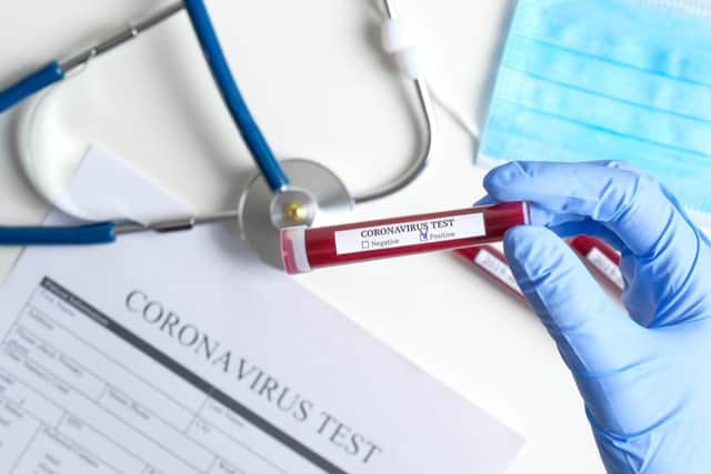 This is what you need to know about how coronavirus affects those with MND (Photo: Shutterstock)