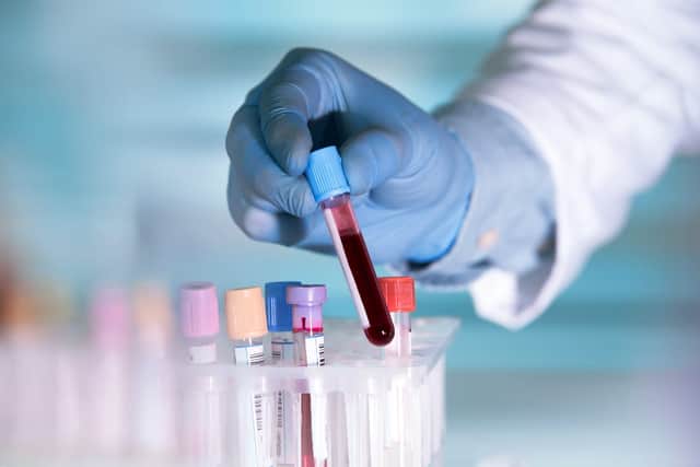 This is not the only study to suggest certain blood types protect people from the virus. (Credit: Shuttersock)
