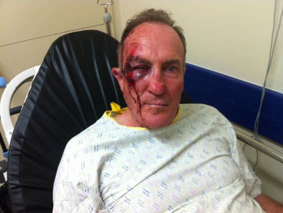Mr Cox after the assault