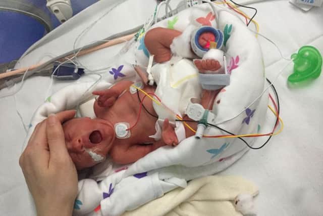 Isabella-Rose went home for the first time two weeks ago after nearly three months in care.