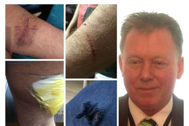Nigel Carr suffered bite marks and grazes to his arms and legs in the attack