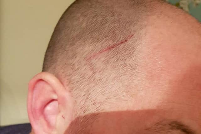 Geoff's injuries included cuts to the head and suspected broken ribs.