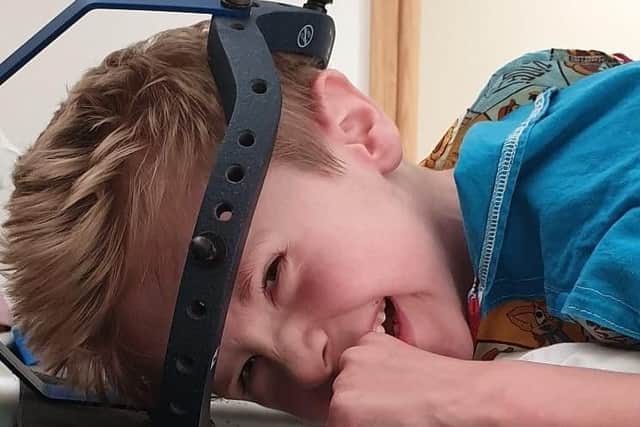Harry (pictured) is wearing a 'halo tibial traction' - he has to lay on a special bed frame everyday and he will be turned many times throughout the day from his front to his back.