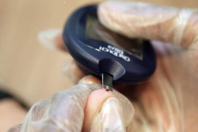 Blood sugar test for diabetes