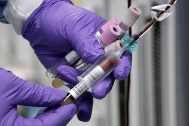 A simple blood test could rule out heart attacks in patients complaining of chest pain and "dramatically" reduce unnecessary admissions to hospital, scientists have found.