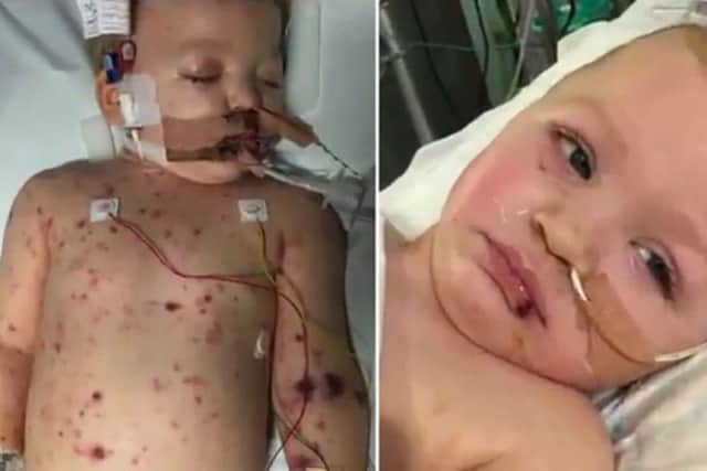 Former Northampton Saints star Matt Dawson shared pictures of his son who battled meningitis to raise awareness of the disease and urge people to sign a petition calling for all children to be vaccinated against it on the NHS. Pic @matt9dawson