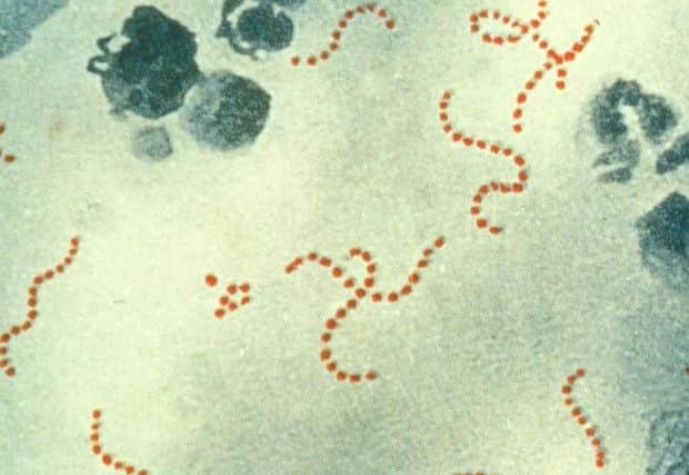 Scarlet fever