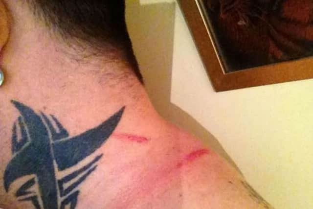 Darren Knagg, landlord of The Fiddlers pub in Northampton, suffered neck injuries after he was attacked by a female customer