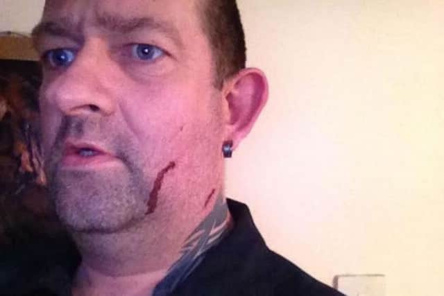Darren Knagg, landlord of The Fiddlers pub in Northampton, suffered a facial injury after he was attacked by a female customer