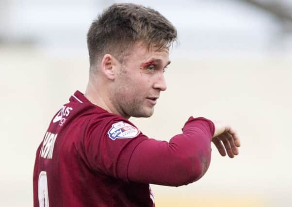 TOUGH AFTERNOON - Joel Byrom was left with a cut above his eye after a late challenge in the 1-1 draw with Cambridge United last Saturday (Picture: Kirsty Edmonds)
