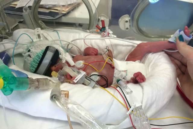 Theo Jamie Abraham was born 13 weeks early, weighing a tiny 1.08kg (2lb6oz)