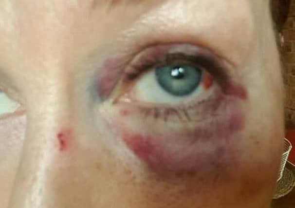 Assault victim Sue, who did not wish her full name used through fear fo repercussions, was attacked in car park three of Northampton General Hospital.