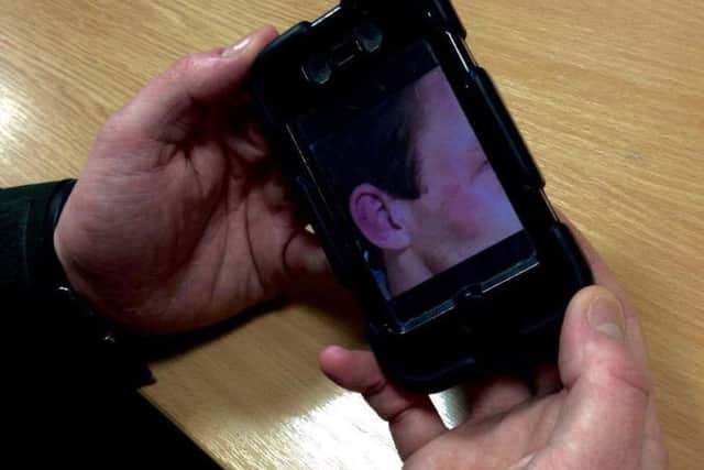 The homeless good Samaritan holds up a picture of his injuries on his phone. He is hoping a fresh witness appeal will bring his attackers to justice.