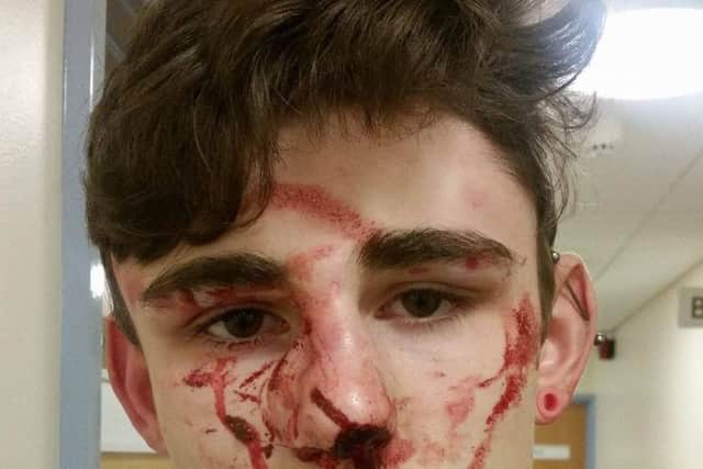 Two young thugs attacked a Northampton teenager while he was riding on his bike in Northampton
