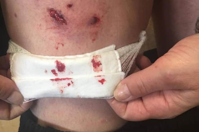 Picture above shows the injuries inflicted by one of the dogs.
