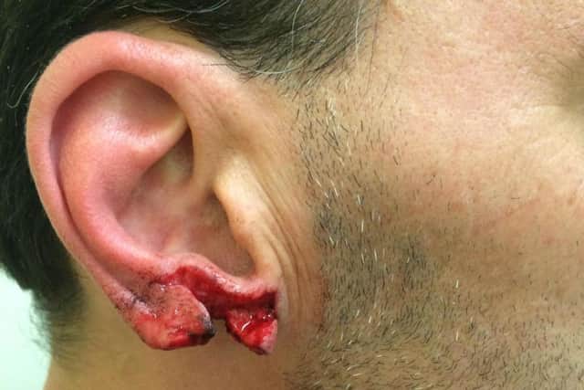 The damage to Ricky Power's ear after the attack. SWNS.