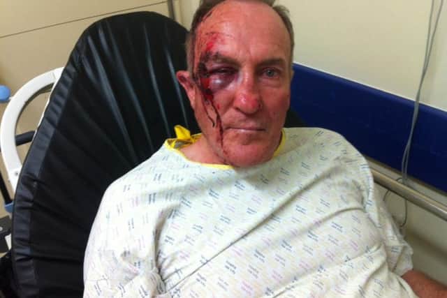 John Cox in 2014 following the attack