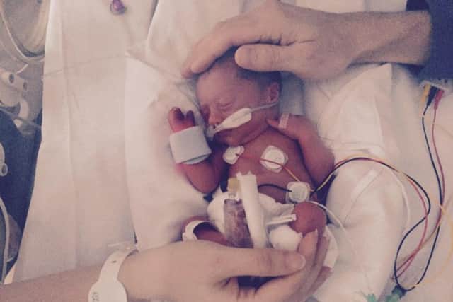 Isabella-Rose was born ten weeks premature at just 2lb 5oz.