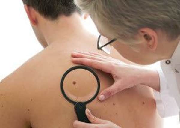 Any change in a mole or mark on your skin should be reported to your GP