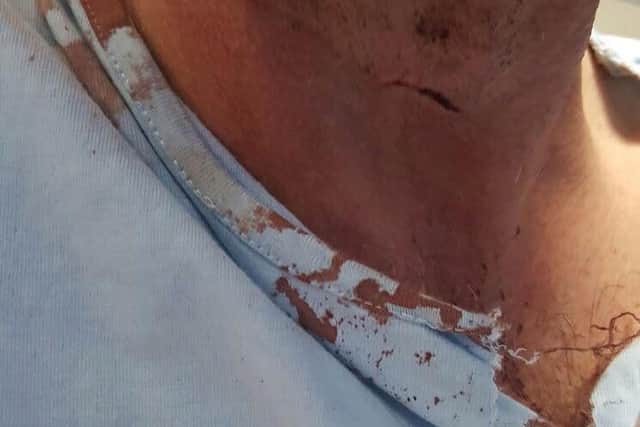 Tony Hogarth only realised his neck had been slashed after it was pointed out to him by some passers-by.