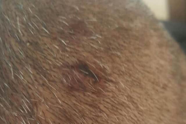The stab wound to Tony's head.
