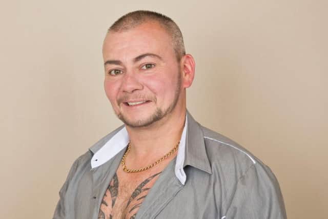 Shay plans to have Shayne Ward's signature tattooed over his surgery scars.