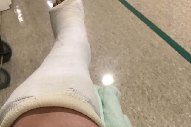 Her leg has been put into cast before medics operate.