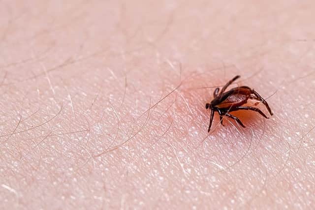 Tick bites can kill