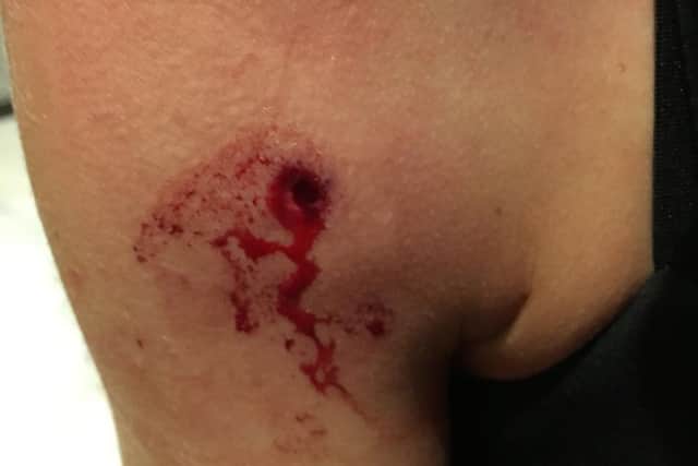 Cristina Meder was left with a nasty puncture wound after being shot near her home in Abington Avenue.
